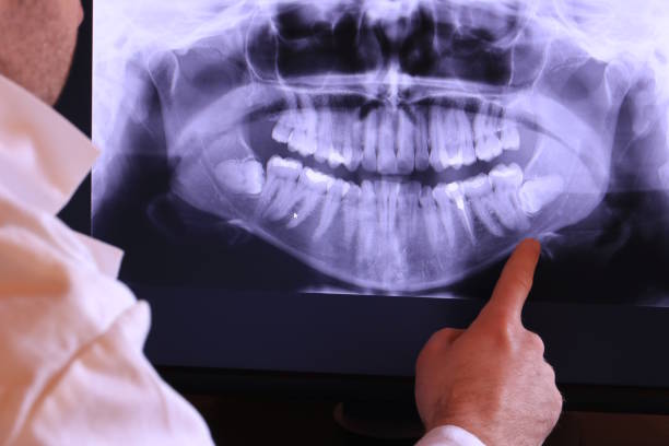 Best Mobile Emergency Dentist in Tenaha, TX